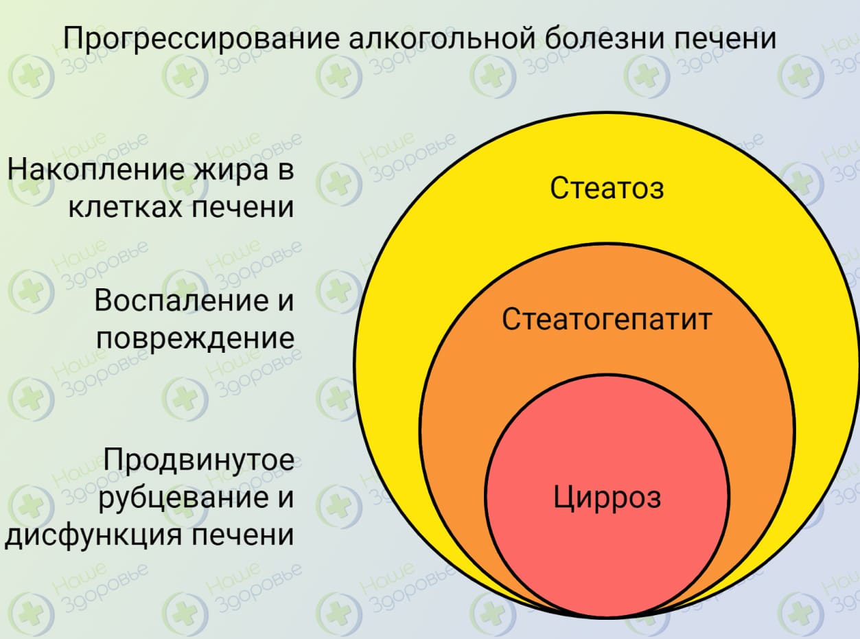 Инфографика нозологических форм